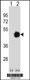 Protein Phosphatase Methylesterase 1 antibody, 59-093, ProSci, Western Blot image 
