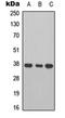 Cathepsin B antibody, orb315768, Biorbyt, Western Blot image 
