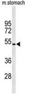 Potassium Voltage-Gated Channel Subfamily J Member 11 antibody, GTX80493, GeneTex, Western Blot image 