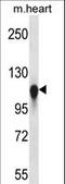 Kinesin Family Member 5C antibody, LS-C165519, Lifespan Biosciences, Western Blot image 