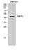 Sirtuin 2 antibody, STJ95668, St John