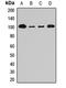 SP100 Nuclear Antigen antibody, LS-C667944, Lifespan Biosciences, Western Blot image 