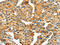 SPARC antibody, CSB-PA190682, Cusabio, Immunohistochemistry paraffin image 