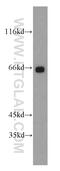 McKusick-Kaufman/Bardet-Biedl syndromes putative chaperonin antibody, 13078-1-AP, Proteintech Group, Western Blot image 