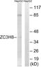 Zinc Finger CCCH-Type Containing 8 antibody, abx015012, Abbexa, Western Blot image 
