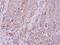 Rho Associated Coiled-Coil Containing Protein Kinase 1 antibody, LS-C186291, Lifespan Biosciences, Immunohistochemistry frozen image 