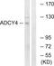 Adenylate Cyclase 4 antibody, LS-C119377, Lifespan Biosciences, Western Blot image 