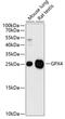 Glutathione Peroxidase 4 antibody, 18-396, ProSci, Western Blot image 