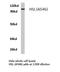 Lipase E, Hormone Sensitive Type antibody, LS-C177164, Lifespan Biosciences, Western Blot image 