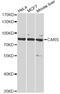 Cysteinyl-TRNA Synthetase antibody, STJ28623, St John
