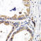 Fatty Acid Binding Protein 3 antibody, 19-580, ProSci, Immunohistochemistry paraffin image 