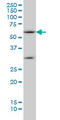 Suppressor Of Cytokine Signaling 5 antibody, LS-C133600, Lifespan Biosciences, Western Blot image 