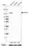 Leucine Rich Pentatricopeptide Repeat Containing antibody, NBP1-83349, Novus Biologicals, Western Blot image 