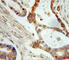 NME/NM23 Nucleoside Diphosphate Kinase 1 antibody, A0259, ABclonal Technology, Immunohistochemistry paraffin image 