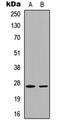 Cyclin Dependent Kinase Inhibitor 1B antibody, orb235086, Biorbyt, Western Blot image 