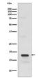 KIT Ligand antibody, M01254, Boster Biological Technology, Western Blot image 