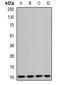 Gamma-aminobutyric acid receptor-associated protein-like 1 antibody, abx142017, Abbexa, Western Blot image 