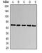 Carcinoembryonic Antigen Related Cell Adhesion Molecule 1 antibody, abx225101, Abbexa, Western Blot image 
