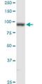 Procollagen-Lysine,2-Oxoglutarate 5-Dioxygenase 2 antibody, H00005352-D01P, Novus Biologicals, Western Blot image 