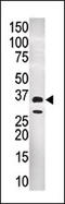 Glycine N-Methyltransferase antibody, 55-405, ProSci, Western Blot image 
