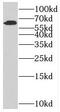 Solute Carrier Family 38 Member 4 antibody, FNab07961, FineTest, Western Blot image 