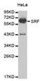 Serum Response Factor antibody, STJ25693, St John