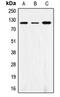 Signal Regulatory Protein Alpha antibody, MBS821406, MyBioSource, Western Blot image 