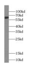 Unc-5 Netrin Receptor D antibody, FNab09264, FineTest, Western Blot image 