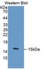 Calc antibody, LS-C293106, Lifespan Biosciences, Western Blot image 