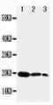 Fibroblast Growth Factor 7 antibody, PA1371, Boster Biological Technology, Western Blot image 