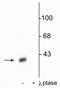 Protein Phosphatase 1 Regulatory Inhibitor Subunit 1B antibody, P03424-1, Boster Biological Technology, Western Blot image 