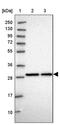 Chromosome 2 Open Reading Frame 49 antibody, PA5-60535, Invitrogen Antibodies, Western Blot image 