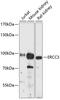 ERCC Excision Repair 3, TFIIH Core Complex Helicase Subunit antibody, 14-588, ProSci, Western Blot image 