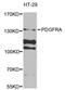 Platelet Derived Growth Factor Receptor Alpha antibody, MBS126886, MyBioSource, Western Blot image 