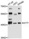 Synaptotagmin 7 antibody, LS-C747837, Lifespan Biosciences, Western Blot image 