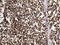 Ubiquitin C-Terminal Hydrolase L1 antibody, LS-C797036, Lifespan Biosciences, Immunohistochemistry paraffin image 