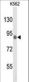 Tousled Like Kinase 1 antibody, LS-C101204, Lifespan Biosciences, Western Blot image 