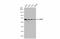 G3BP Stress Granule Assembly Factor 1 antibody, GTX112191, GeneTex, Western Blot image 