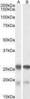 Tubulin Polymerization Promoting Protein antibody, LS-B9213, Lifespan Biosciences, Western Blot image 