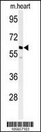 Protein Phosphatase, Mg2+/Mn2+ Dependent 1G antibody, 63-468, ProSci, Western Blot image 