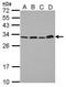 Proteasome Activator Subunit 1 antibody, GTX118374, GeneTex, Western Blot image 