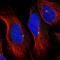 McKusick-Kaufman Syndrome antibody, HPA044233, Atlas Antibodies, Immunofluorescence image 