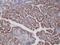 B-Raf Proto-Oncogene, Serine/Threonine Kinase antibody, NBP2-61503, Novus Biologicals, Immunohistochemistry paraffin image 