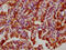 Heat Shock Protein Family B (Small) Member 1 antibody, CSB-RA010833A82phHU, Cusabio, Immunohistochemistry paraffin image 