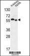 Solute Carrier Family 47 Member 2 antibody, 61-638, ProSci, Western Blot image 