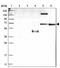 Coenzyme A Synthase antibody, PA5-54633, Invitrogen Antibodies, Western Blot image 