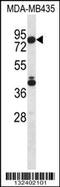 Sphingosine-1-phosphate lyase 1 antibody, 56-615, ProSci, Western Blot image 