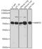 Matrix Metallopeptidase 25 antibody, A07939, Boster Biological Technology, Western Blot image 