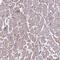 Troponin C2, Fast Skeletal Type antibody, PA5-60269, Invitrogen Antibodies, Immunohistochemistry frozen image 