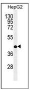 Retinol dehydrogenase 13 antibody, AP53624PU-N, Origene, Western Blot image 